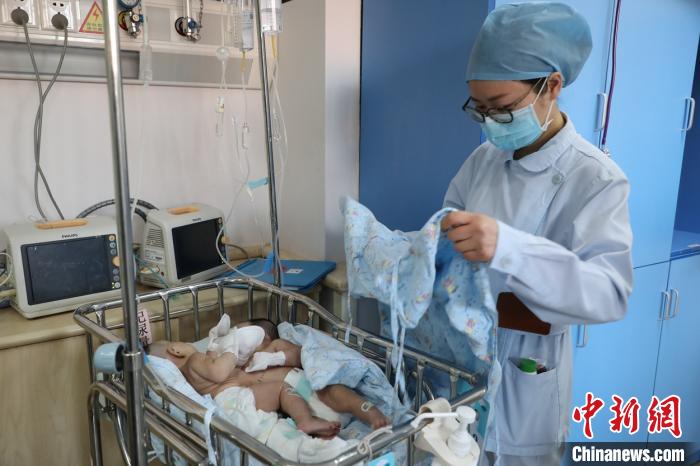儿科医院重症监护病房(NICU)精心照顾联体姐妹。儿科医院供图 儿科医院重症监护病房(NICU)精心照顾联体姐妹。儿科医院供图
